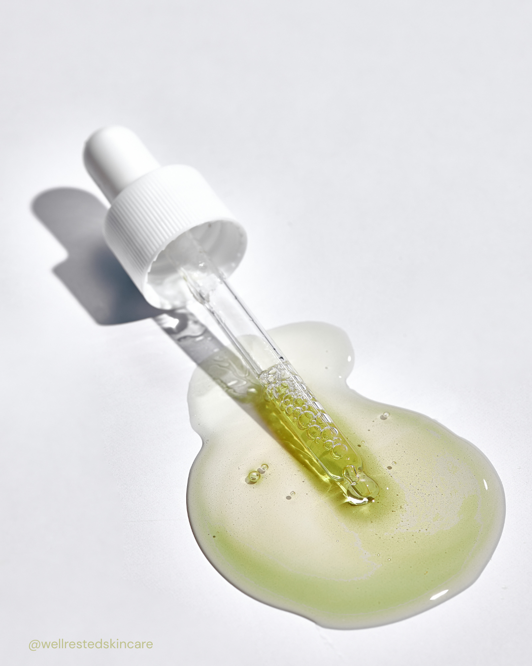 Azelaic Acid for Rosacea, Melasma & Hyperpigmentation