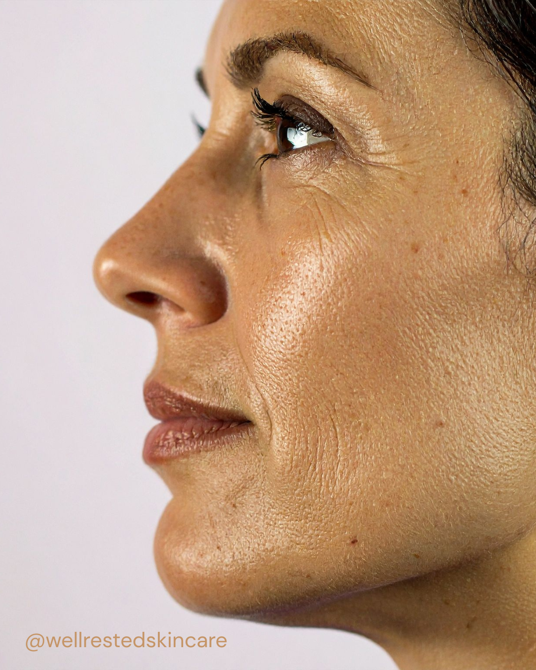 GLP-1 Medications and Your Skin