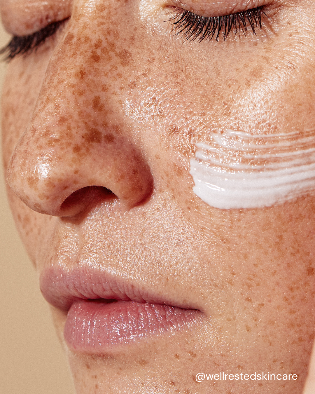 The Pigmentation Stack: 5 Layers That Fade Dark Spots